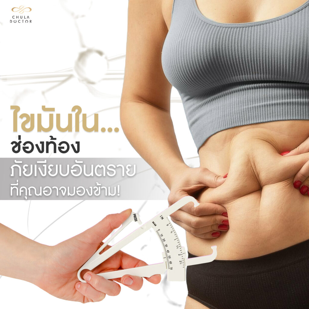 ไขมันในช่องท้อง (Visceral Fat) ภัยเงียบอันตรายที่คุณอาจมองข้าม!