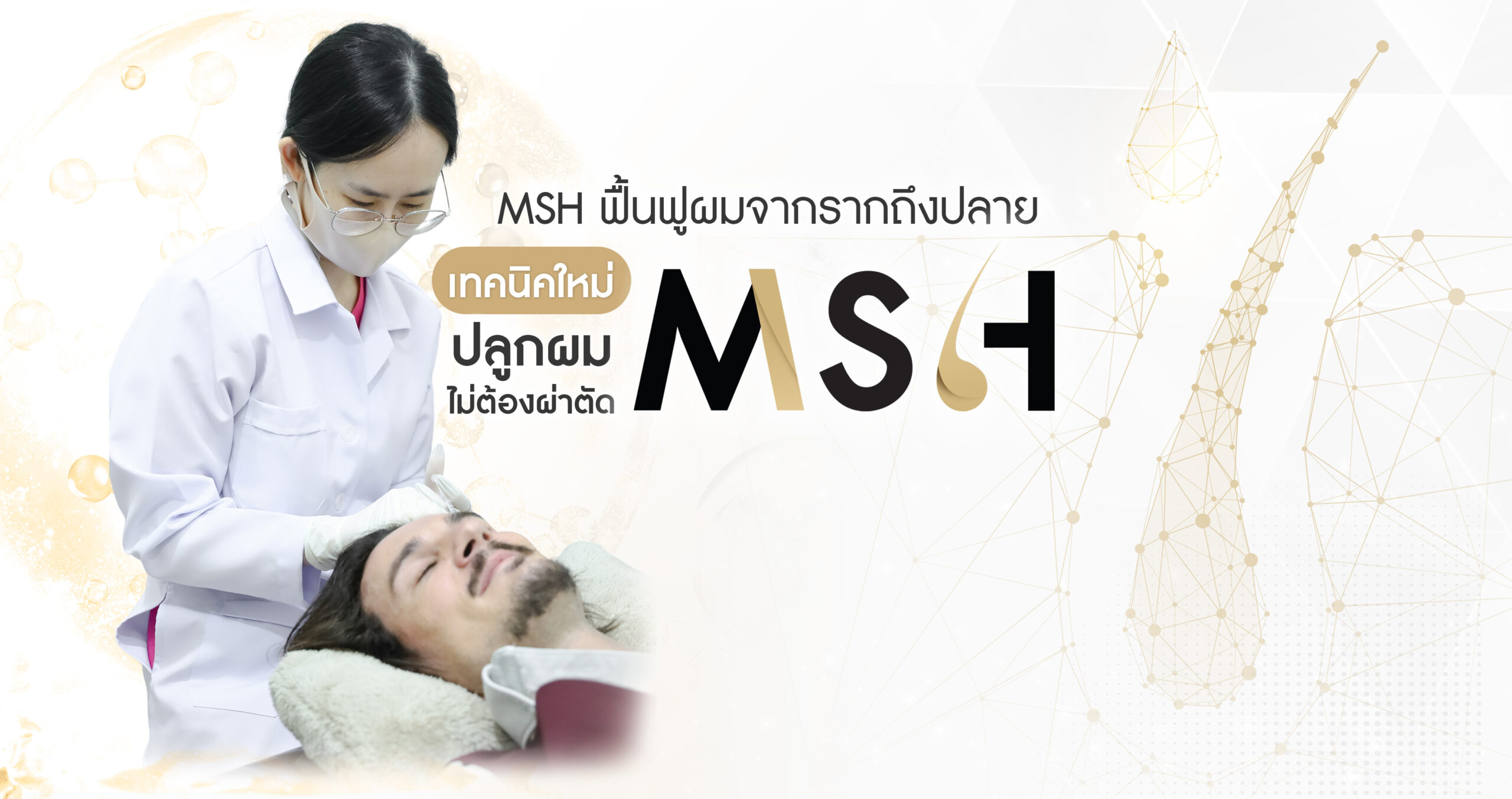 MSH ปลูกผม