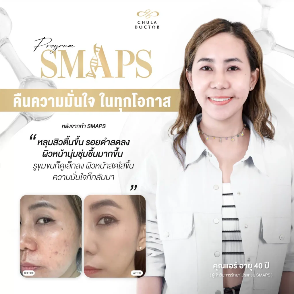 รีวิว รักษาฝ้า