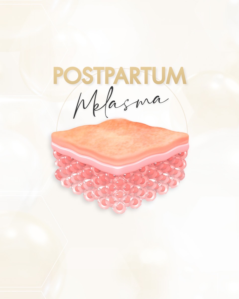 Postpartum Melasma