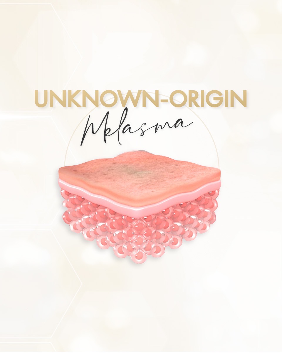 Unknown-Origin Melasma